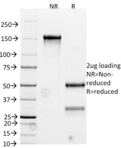 Bcl-2 Antibody (BCL2/782), Novus Biologicals 0.2mg; Unlabeled:Antibodies,